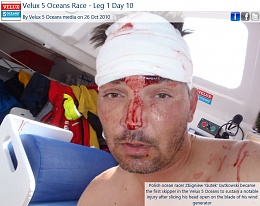 Click image for larger version

Name:	Wind Generator hurt Sailor.jpg
Views:	391
Size:	98.1 KB
ID:	103110